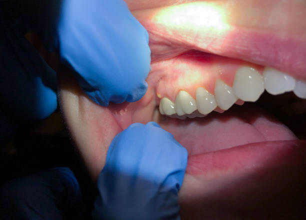 Best Pediatric Emergency Dentist in Kronenwetter, WI