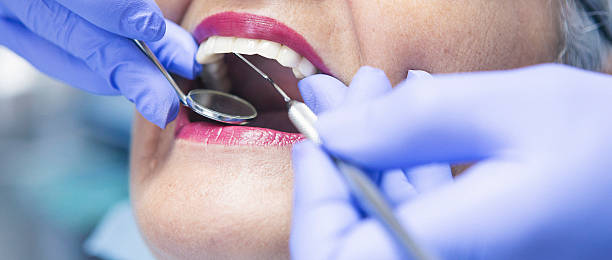 Best Emergency Wisdom Teeth Removal in Kronenwetter, WI